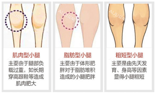需要<span style=