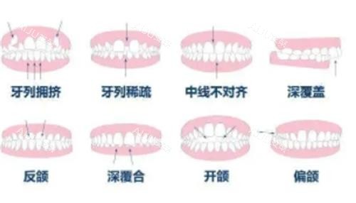 牙齿的常见问题