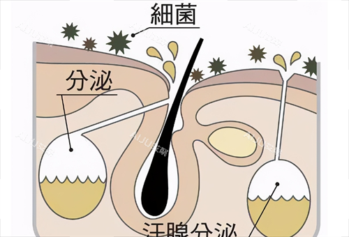 腋臭毛囊汗腺分泌动画展示