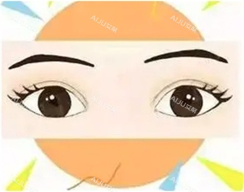 美眼攻略！不开眼角割双眼皮怎么样？适用于内眼角赘皮不明显等人群