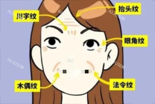 请问：川字纹是打玻尿酸好还是打除皱好？从成效/维持时间/适应人群/可靠性及风险进行对比
