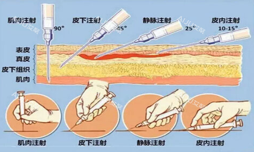 玻尿酸皮层示意图