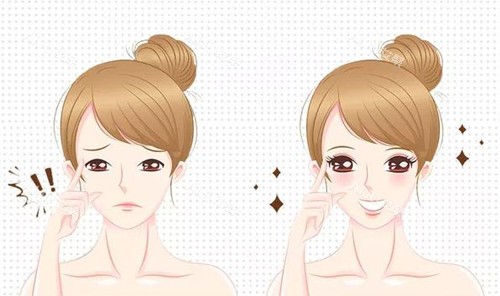 双眼皮手术前后对比动画图