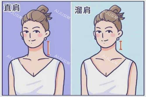 溜肩直角肩卡通对比图