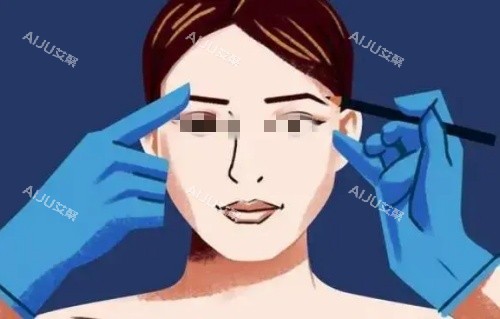 拉双眼皮