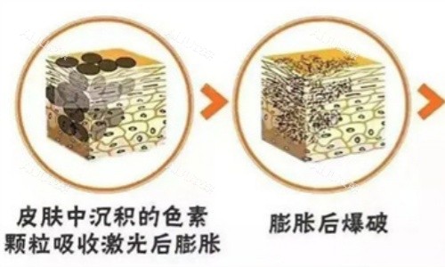 超皮秒原理