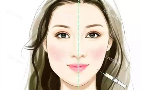 郑州圣熙格兰整形瘦脸对比