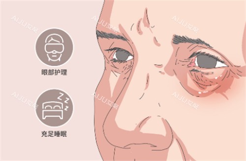 郑州圣熙格兰整形眼部护理