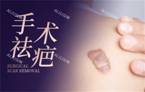 手术疤痕怎么才能去除？轻度疤痕可通过激光及药物治疗，而重度疤痕手术才能去除