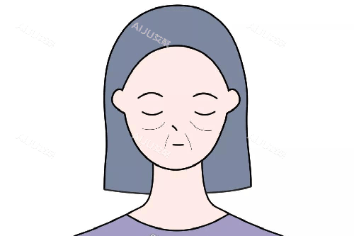 面部法令纹卡通示意图 