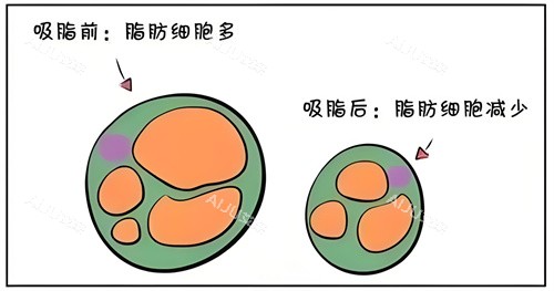 郑州梨花雨整形吸脂前后脂肪细胞对比动画图