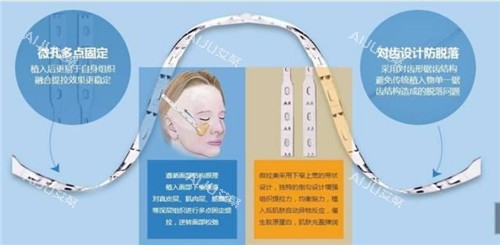 微拉美提升过程图 微拉美提升过程图