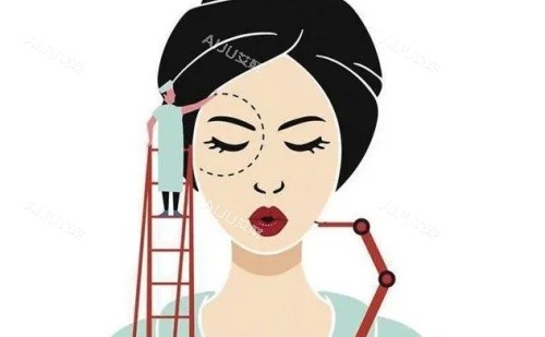 Kiss双眼皮示意图