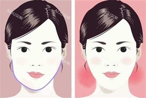 面部不对称和正常面部的区别 面部不对称和正常面部的区别