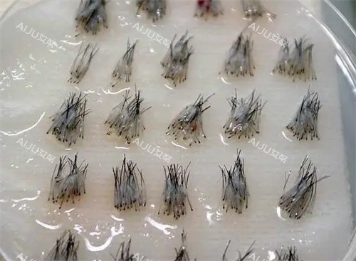 毛囊照片
