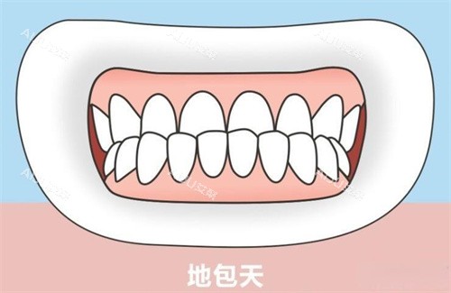 地包天正面演示动画图