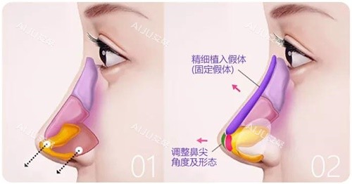 鼻综合示意图 鼻综合示意图