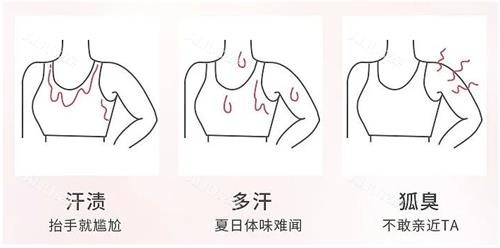 miradry微波的适用人群 miradry微波的适用人群