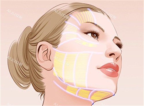 面部拉皮区域动画演示图 面部拉皮区域动画演示图