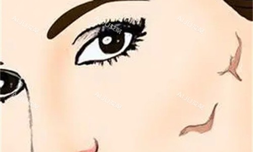 重庆东上整形疤痕科简介+特色项目+收费价格及地址一览，面部身体烧伤疤痕治疗好