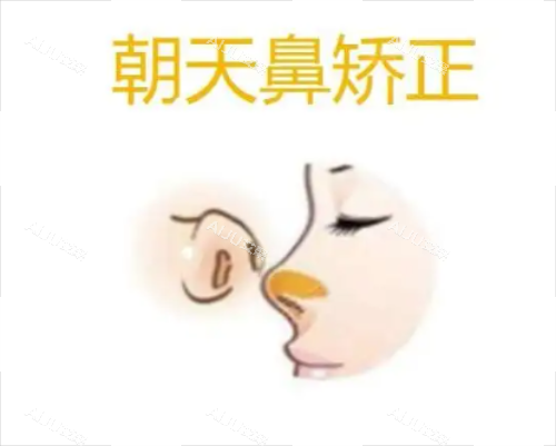 朝天鼻矫正