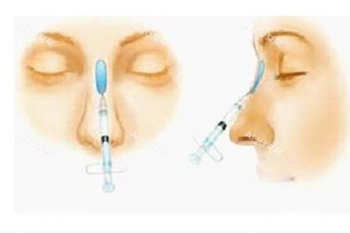薇丽兰骨雕鼻示意图
