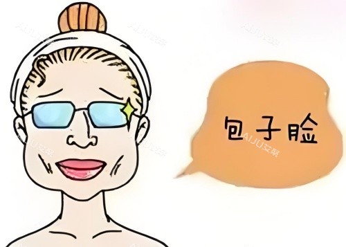 面部过宽示意图