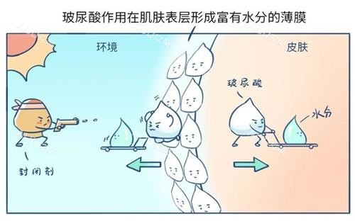 欧提拉玻尿酸作用示意图