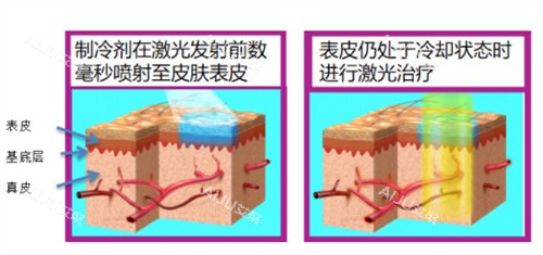595染料激光原理