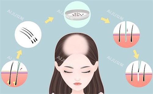 章光生发步骤
