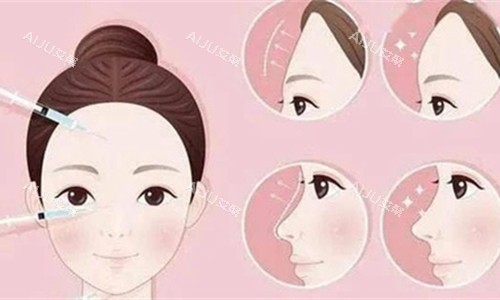 莫纳丽莎玻尿酸面部注射对比图