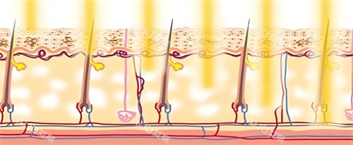 光子嫩肤作用图