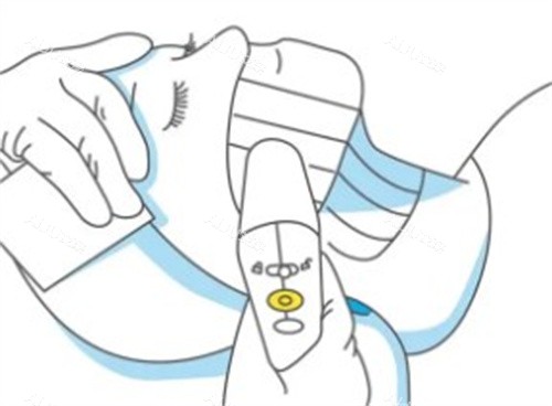 超声炮操作中 超声炮操作中