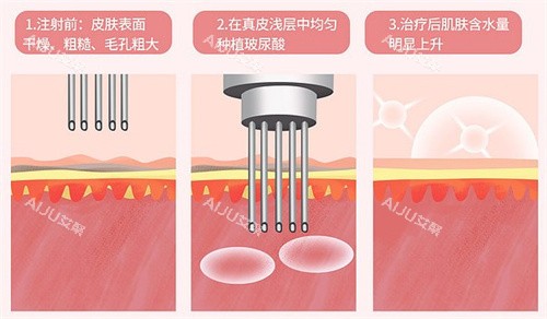 氐殊三文鱼水光作用对比