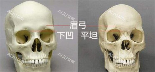 眉弓骨对比展示骨骼图