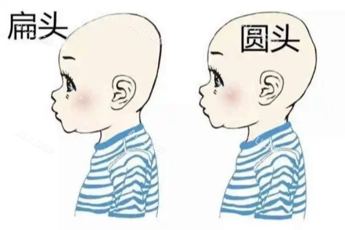 圆头、扁头对比图 圆头、扁头对比图