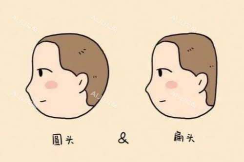 圆头扁头卡通对比图 圆头扁头卡通对比图