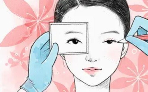 开眼角手术示意图 开眼角手术示意图