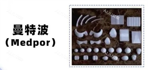 曼特波超肋骨