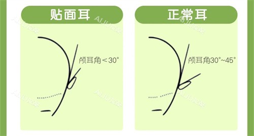 耳基底注射前后对比图