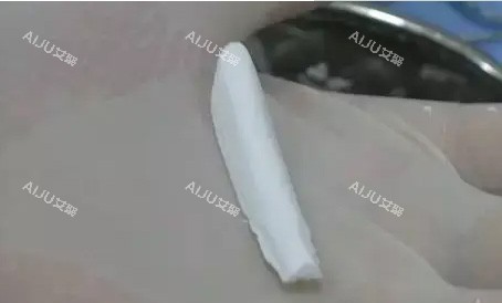 菲思挺膨体价格是多少？基础价格在2w元起，高端价格在3w元起！