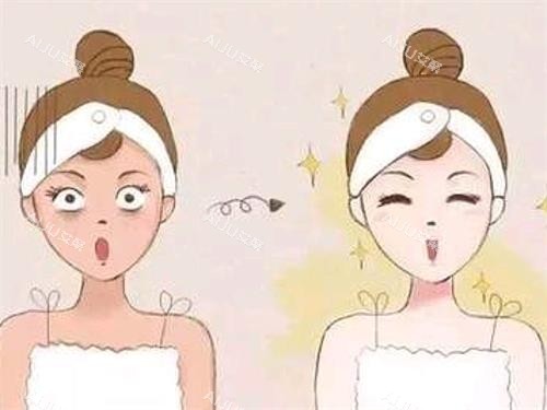 光子嫩肤前后的对比 光子嫩肤前后的对比