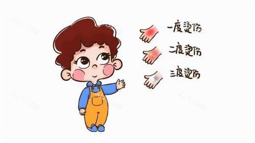 烧烫伤分类图