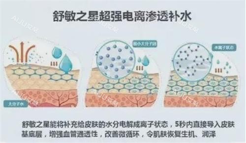 舒敏之星原理