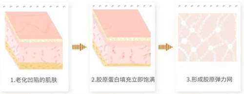 润蕾雅三型胶原蛋白工作原理