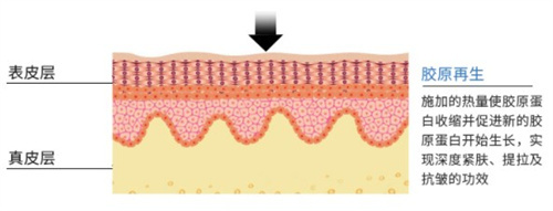 胶原蛋白再生 胶原蛋白再生