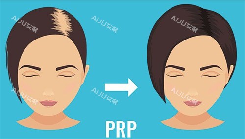 发缝加密植发前后对比图 发缝加密植发前后对比图