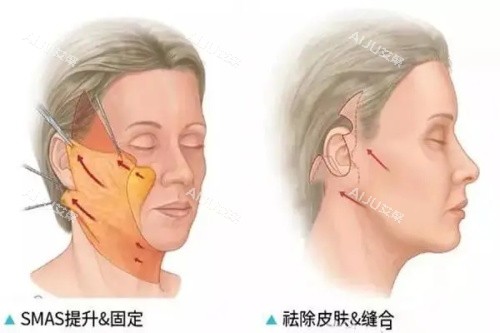 苏顺清医生在哪家医院坐诊？坐诊东莞西妃整形，附医生拉皮等优势|收费价格等