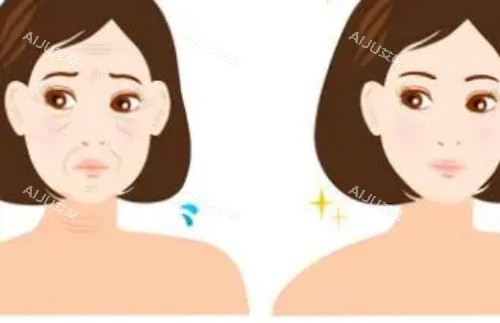 妍姿态面部填充示意图 妍姿态面部填充示意图