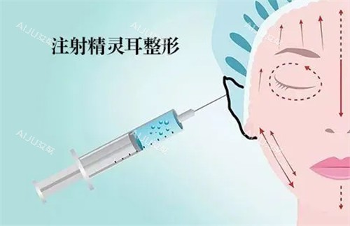 精灵耳注射动画图 精灵耳注射动画图